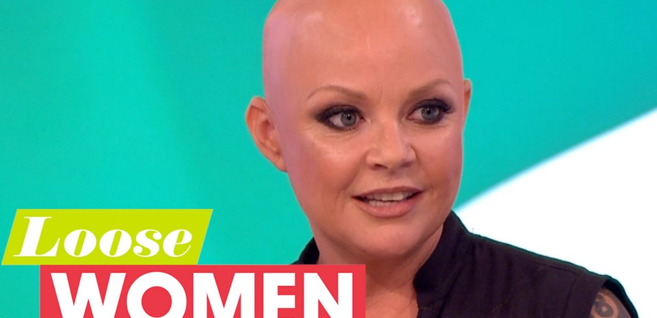 Gail Porter - Female Model TV Presenter Suffers Alopecia